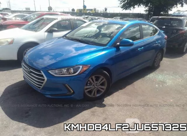 KMHD84LF2JU657325 фото 3