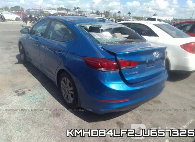 KMHD84LF2JU657325 фото 4