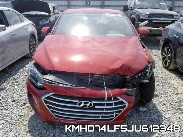 KMHD74LF5JU612348 фото 10
