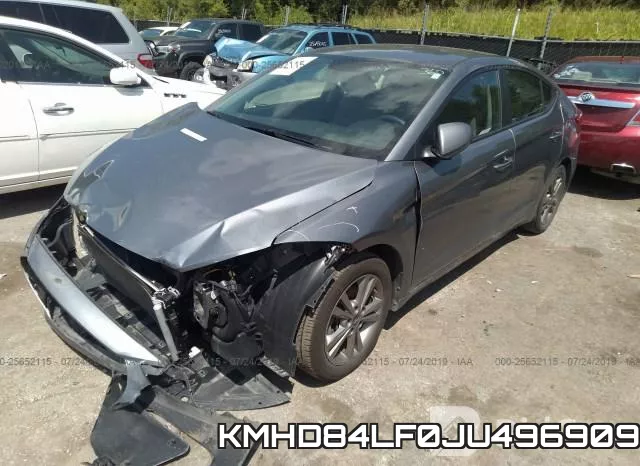 KMHD84LF0JU496909 фото 3
