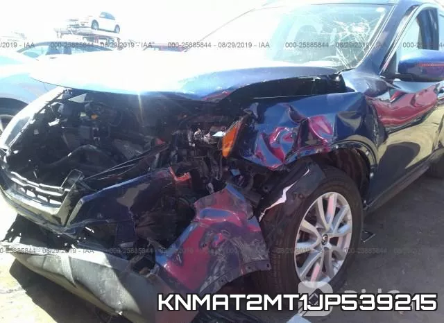 KNMAT2MT1JP539215 фото 7