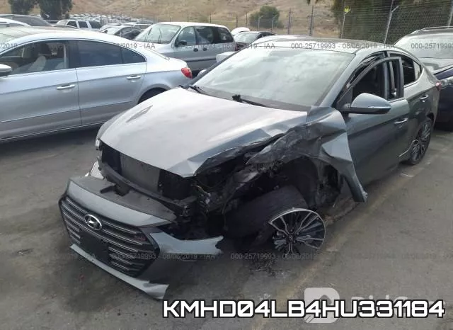 KMHD04LB4HU331184 фото 3