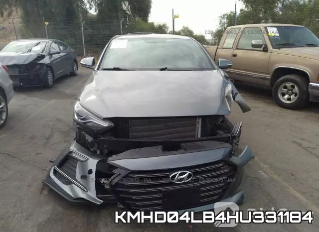 KMHD04LB4HU331184 фото 7