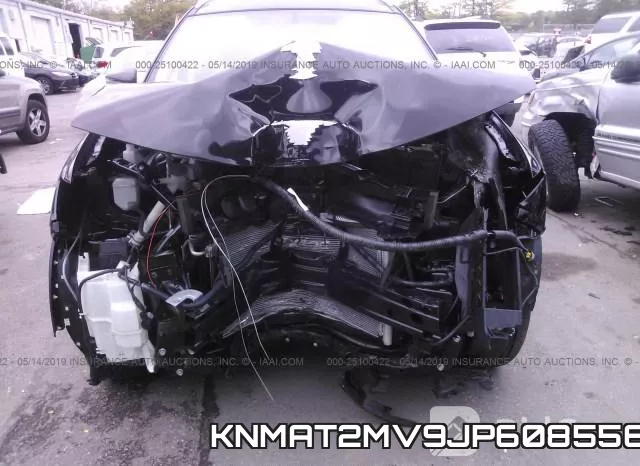 KNMAT2MV9JP608556 фото 7