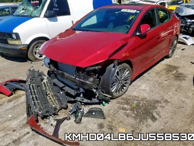 KMHD04LB6JU558530 фото 3