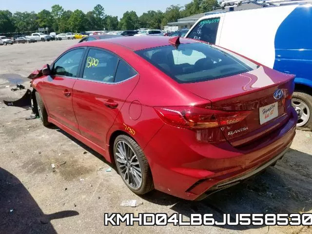 KMHD04LB6JU558530 фото 4