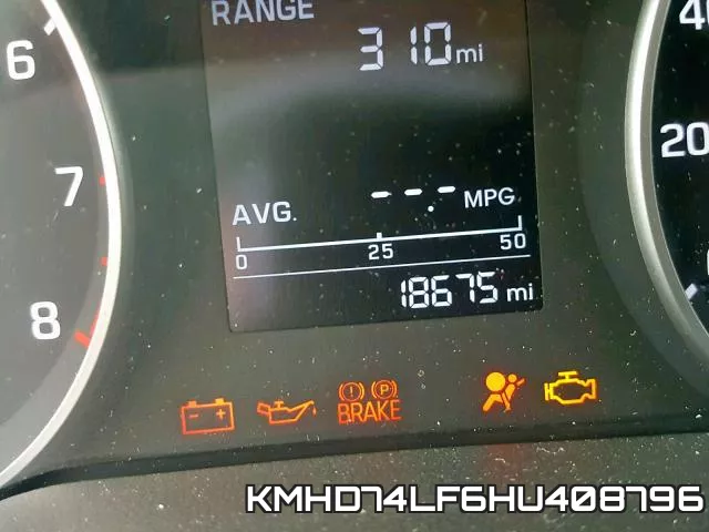 KMHD74LF6HU408796 фото 9