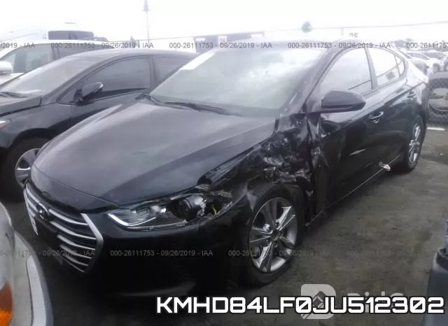 KMHD84LF0JU512302 фото 3