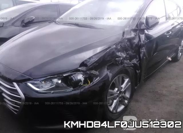 KMHD84LF0JU512302 фото 7
