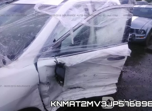 KNMAT2MV3JP576896 фото 7