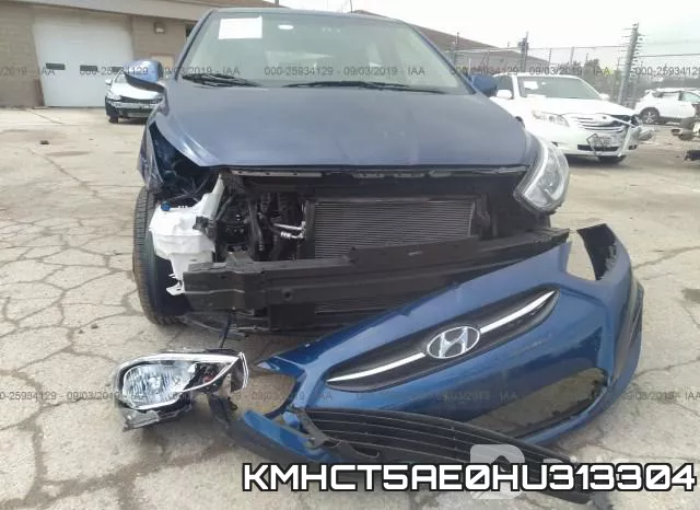 KMHCT5AE0HU313304 фото 7