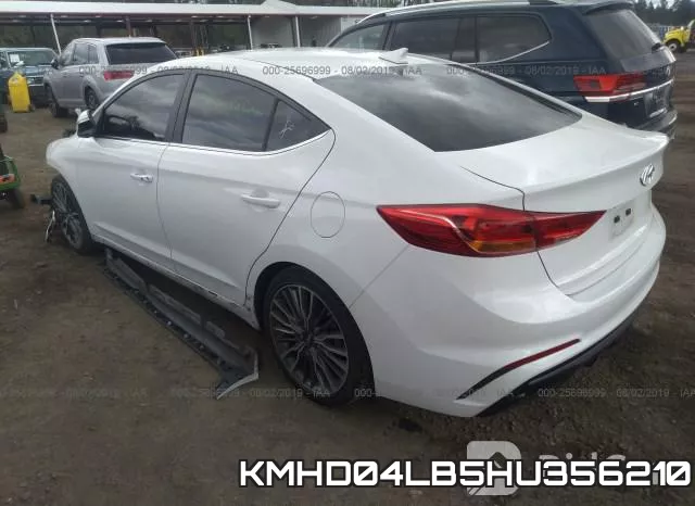 KMHD04LB5HU356210 фото 4