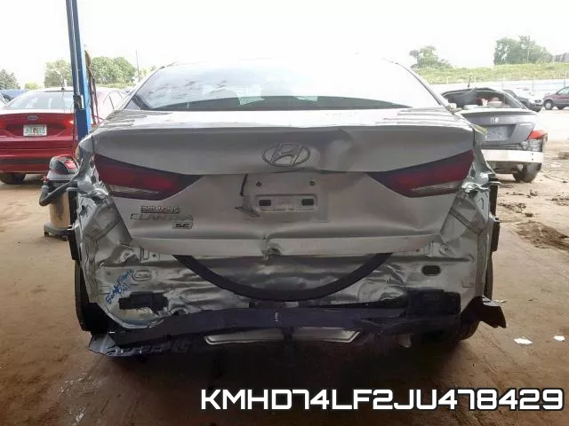 KMHD74LF2JU478429 фото 10