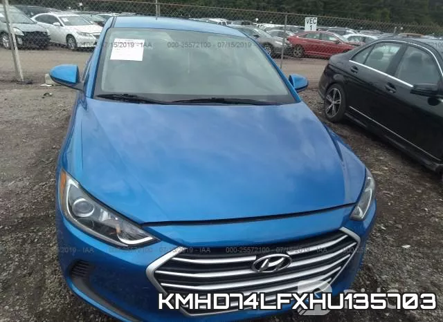 KMHD74LFXHU135703 фото 7