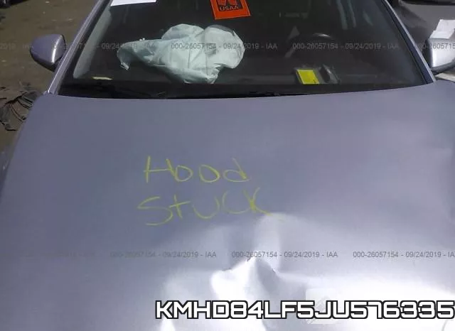 KMHD84LF5JU576335 фото 2
