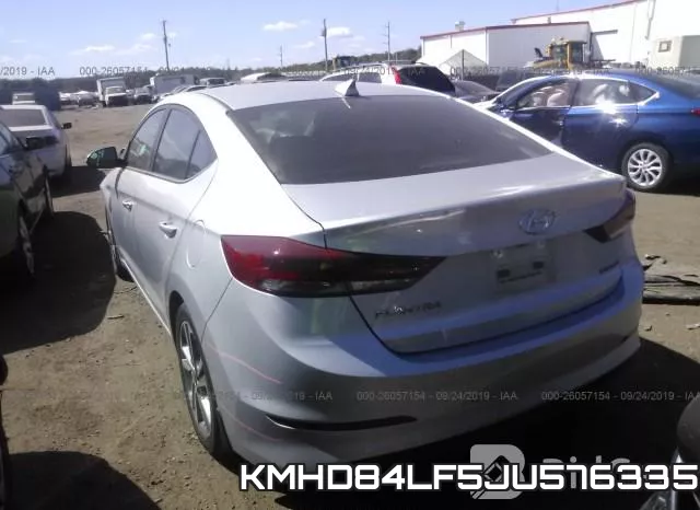 KMHD84LF5JU576335 фото 4