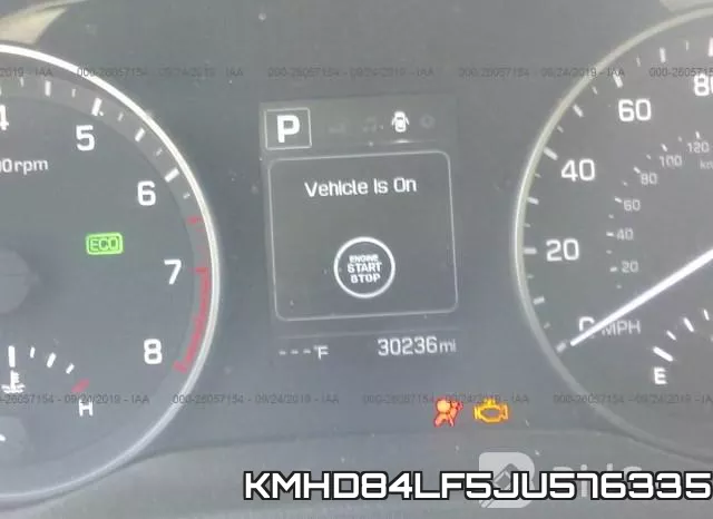 KMHD84LF5JU576335 фото 8