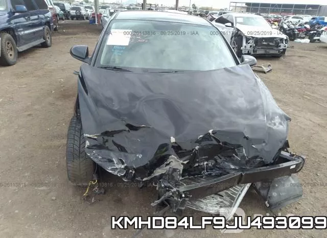 KMHD84LF9JU493099 фото 7
