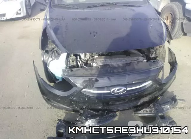 KMHCT5AE3HU310154 фото 7