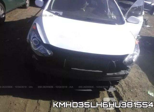 KMHD35LH6HU381554 фото 7