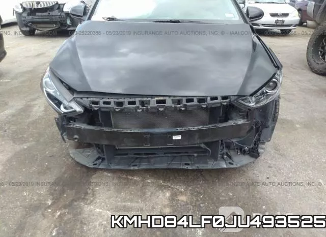 KMHD84LF0JU493525 фото 7