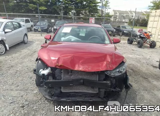 KMHD84LF4HU065354 фото 6