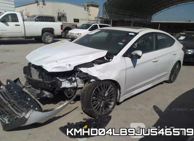 KMHD04LB9JU546579 фото 3