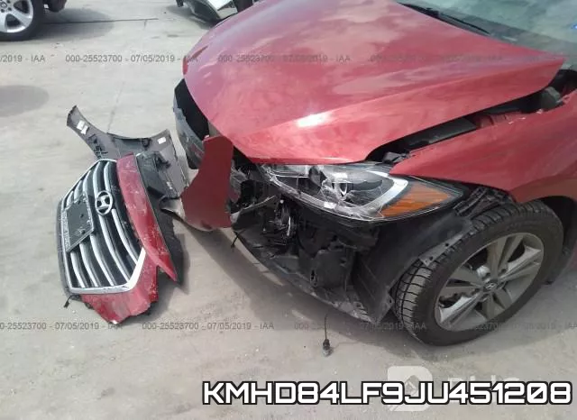 KMHD84LF9JU451208 фото 7