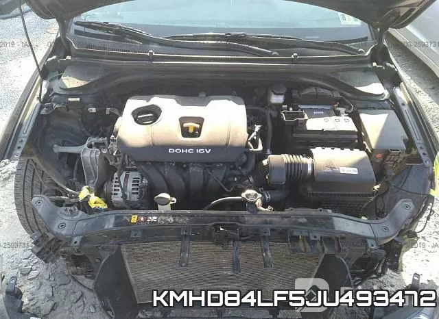 KMHD84LF5JU493472 фото 2