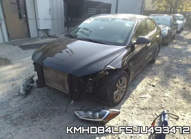 KMHD84LF5JU493472 фото 3
