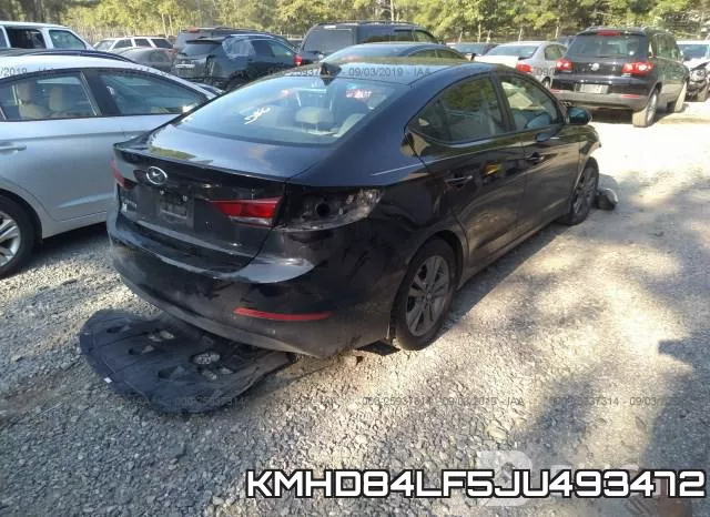 KMHD84LF5JU493472 фото 5