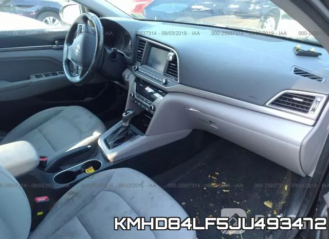 KMHD84LF5JU493472 фото 6