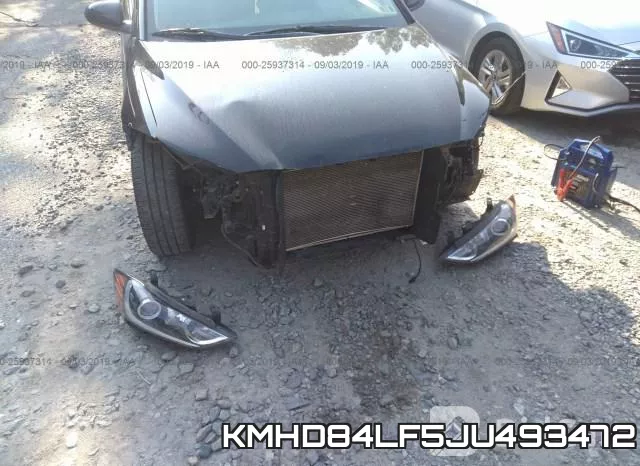 KMHD84LF5JU493472 фото 7
