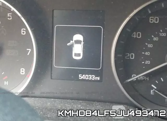 KMHD84LF5JU493472 фото 8