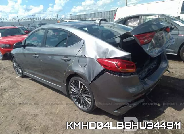 KMHD04LB8HU344911 фото 4