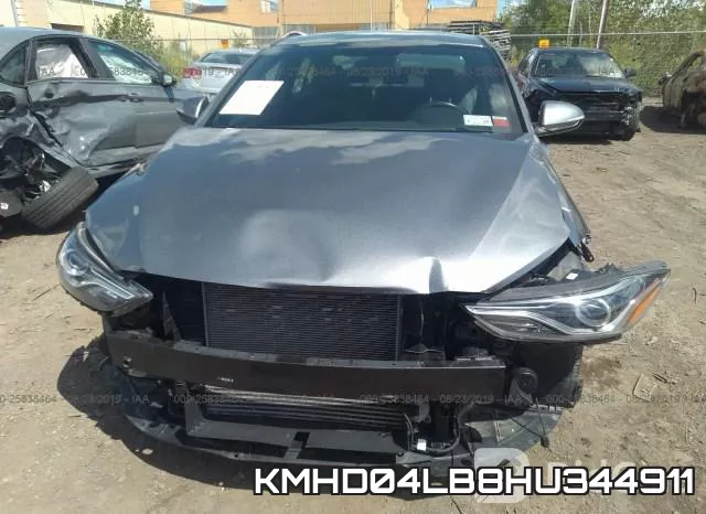 KMHD04LB8HU344911 фото 7