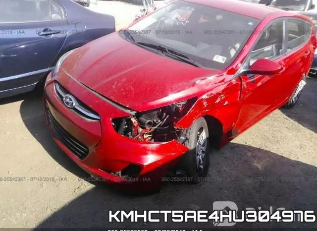 KMHCT5AE4HU304976 фото 7