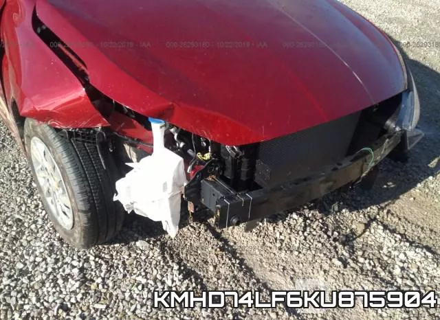 KMHD74LF6KU875904 фото 7