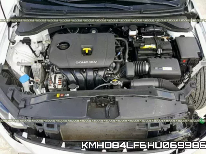 KMHD84LF6HU069986 фото 8