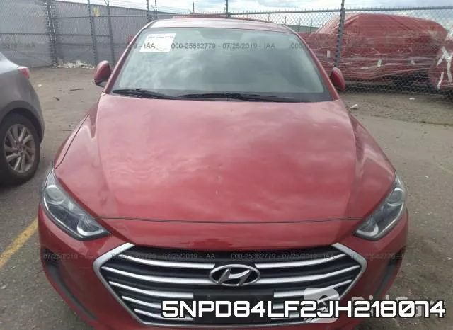 5NPD84LF2JH218074 фото 7