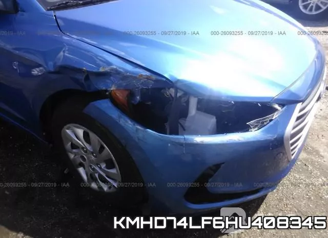 KMHD74LF6HU408345 фото 7