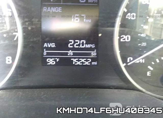 KMHD74LF6HU408345 фото 8