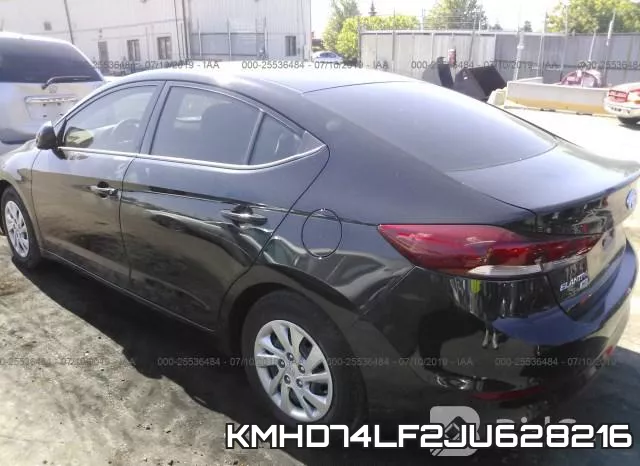 KMHD74LF2JU628216 фото 4