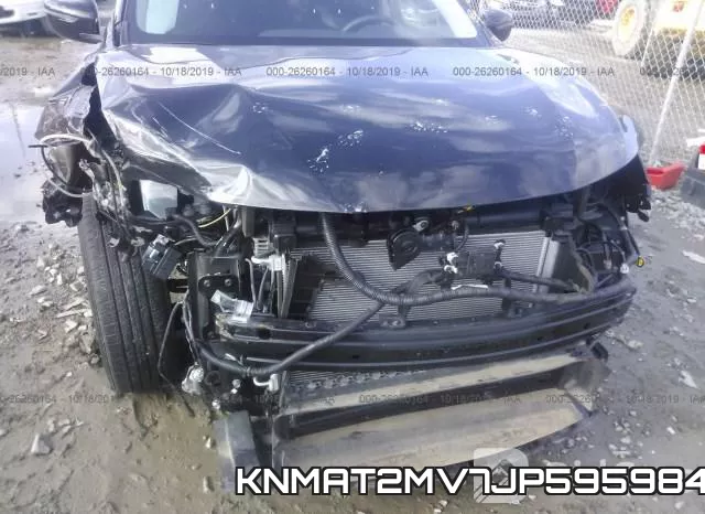 KNMAT2MV7JP595984 фото 7