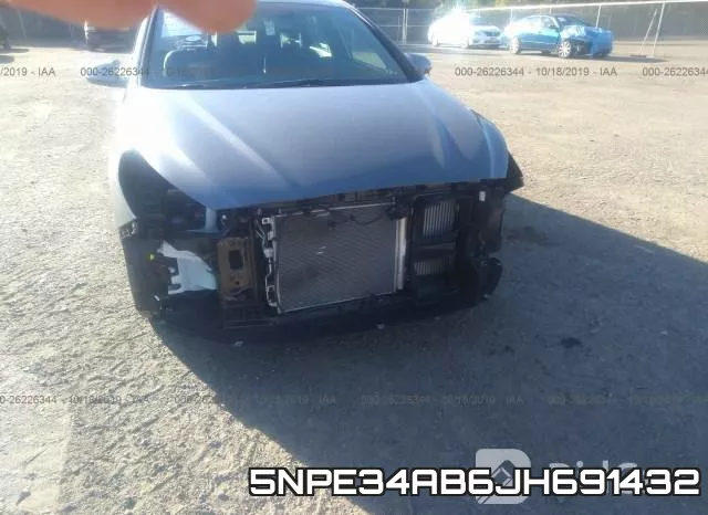 5NPE34AB6JH691432 фото 7