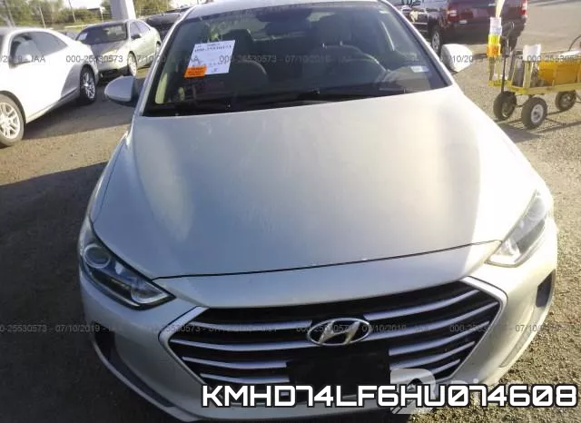 KMHD74LF6HU074608 фото 7
