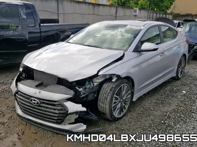 KMHD04LBXJU498655 фото 3