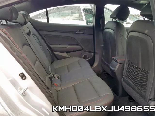 KMHD04LBXJU498655 фото 7