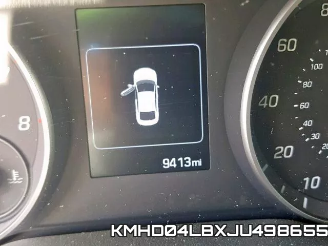 KMHD04LBXJU498655 фото 9