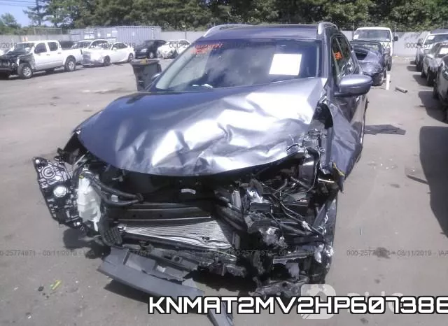 KNMAT2MV2HP607386 фото 7